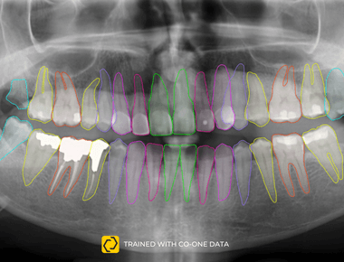Dental Disease Identification through AI-Powered Analysis